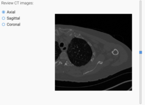 Advita Active Intelligence AI One CT Scan Xray