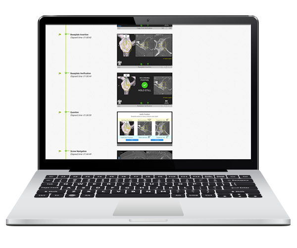Shoulder Planning App