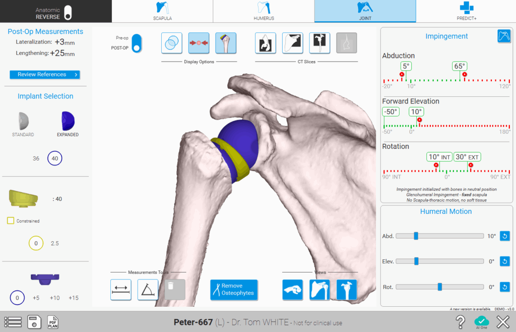 Shoulder Planning App