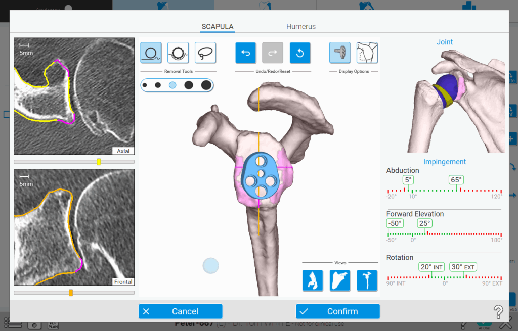 Shoulder Planning App