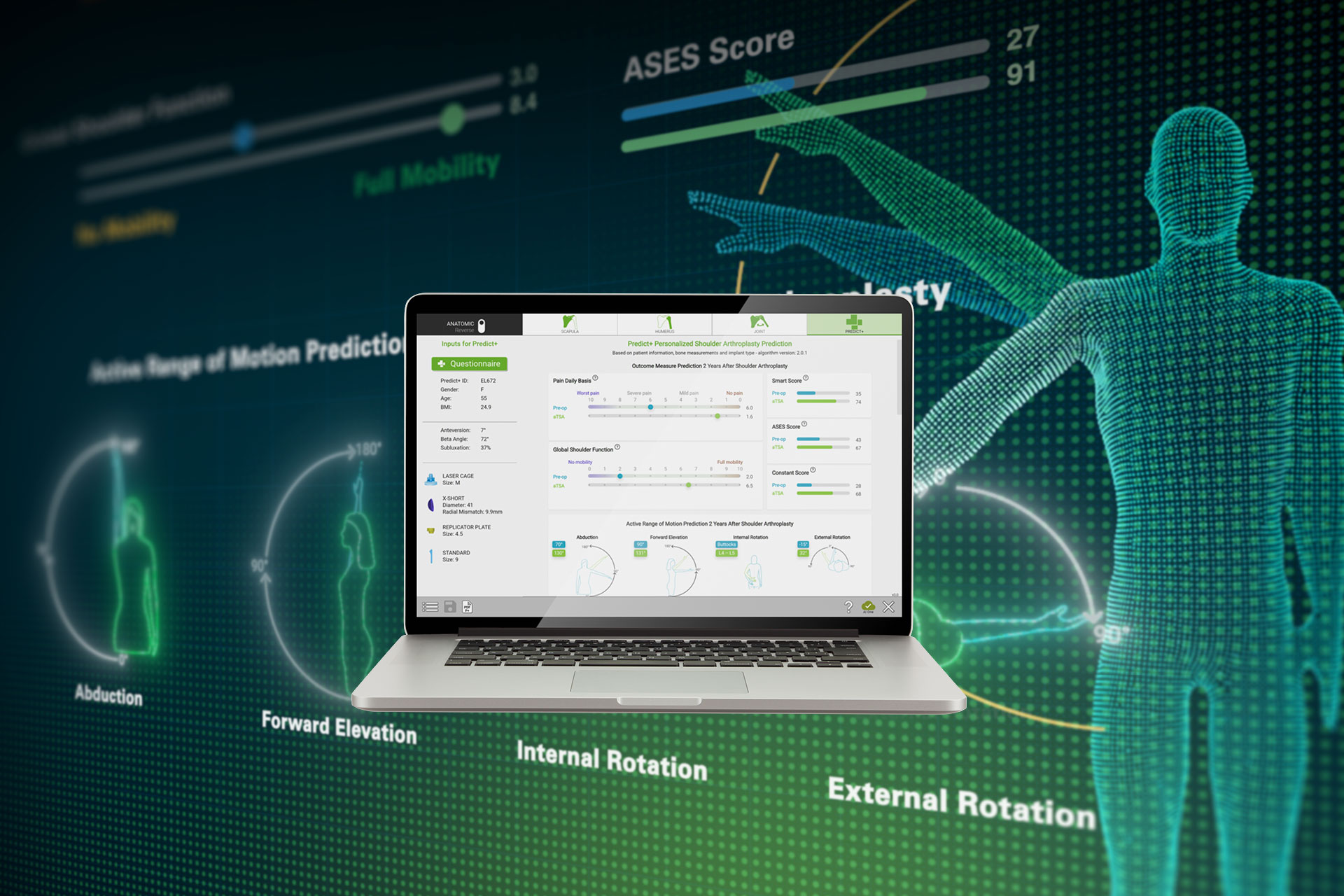 Predict+ Ergebnisprognose